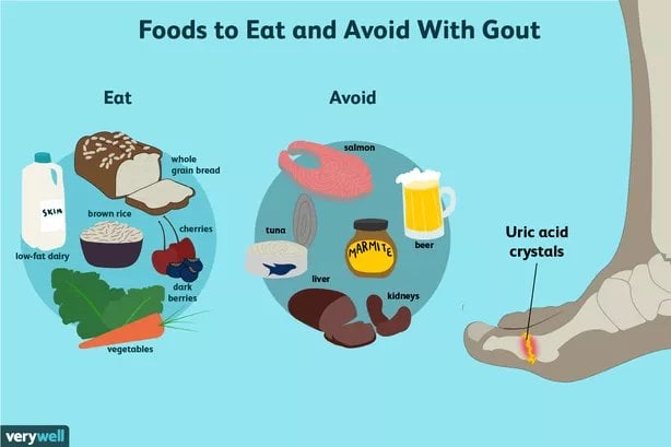 foods to eat and avoid gout