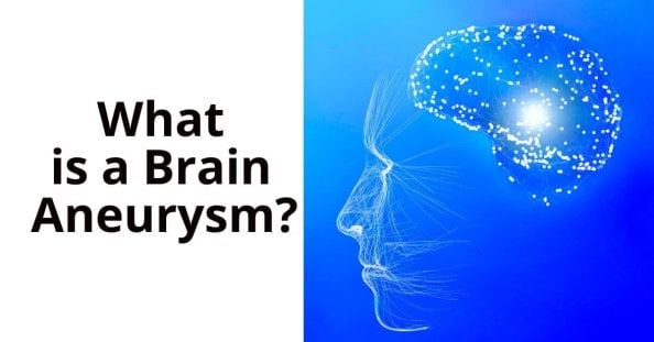 Brain Aneurysm, Definition