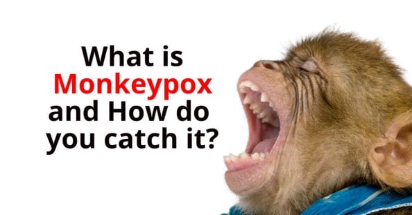 What is monkeypox and how can it be contracted?