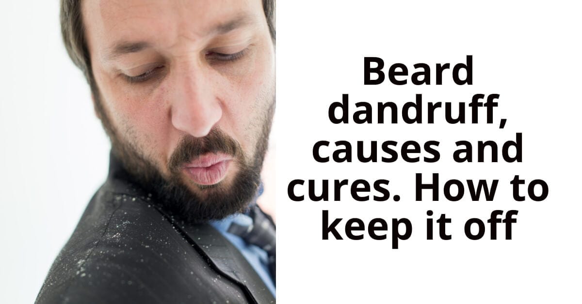beard dandruff