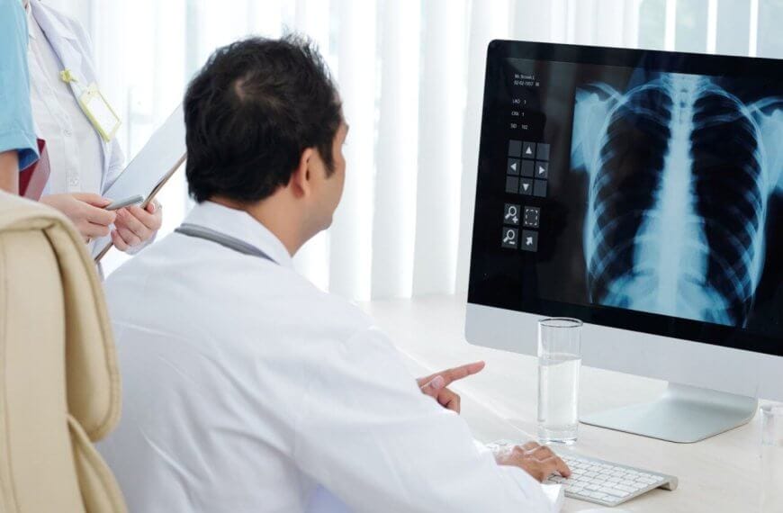 A doctor in a white coat, recognized as the best pulmonologist in Metro Manila, examines a chest X-ray image displayed on a computer monitor. Next to the doctor, a nurse in a blue uniform holds a clipboard and stands. A glass of water and keyboard are on the desk. Vertical blinds cover the window in the background.